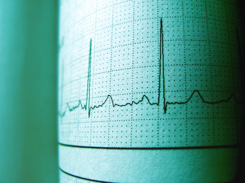 Wearable Heart Monitors-pexels.png