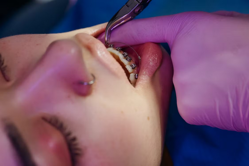 advances-orthodontic-care.png