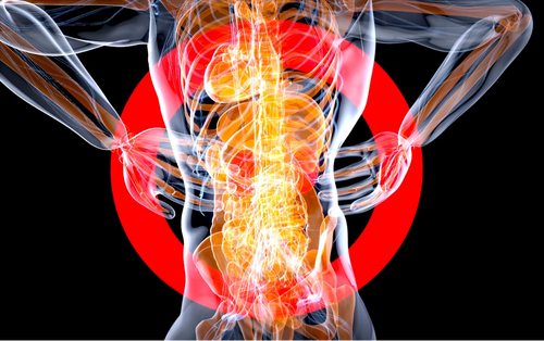 Complex Regional Pain Syndrome
