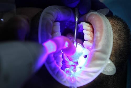Gut Health and Your Oral Microbiome