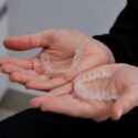 Invisalign or Veneers Singapore
