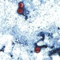 CDC image demonstrating three stained Cyclospora cayetanensis oocysts