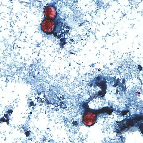 CDC image demonstrating three stained Cyclospora cayetanensis oocysts