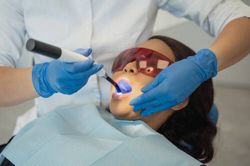 choosing dental curing lights