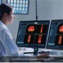 hyperthermia_treatment_planning-_hyperplan
