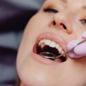 periodontal-disease-heart-disease-pexels