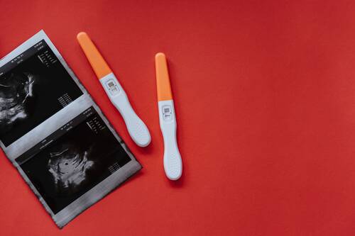 understanding-ivf-abroad-pexels
