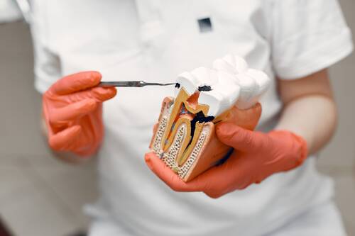 what-to-eat-after-root-canal.jpg