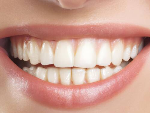 Cosmetic Dentistry Options