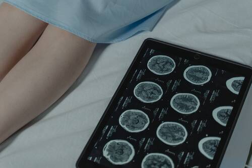 Treatment Options for Brain Tumours