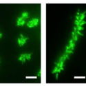 hairy bacteria