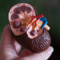 Living With Chronic Kidney Disease-pexels.png