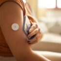 continous glucose monitoring