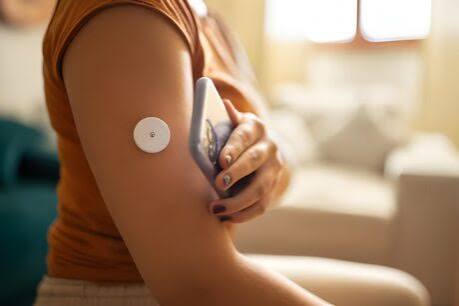 continous glucose monitoring