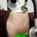 laser-liposuction-singapore-pexels.jpg