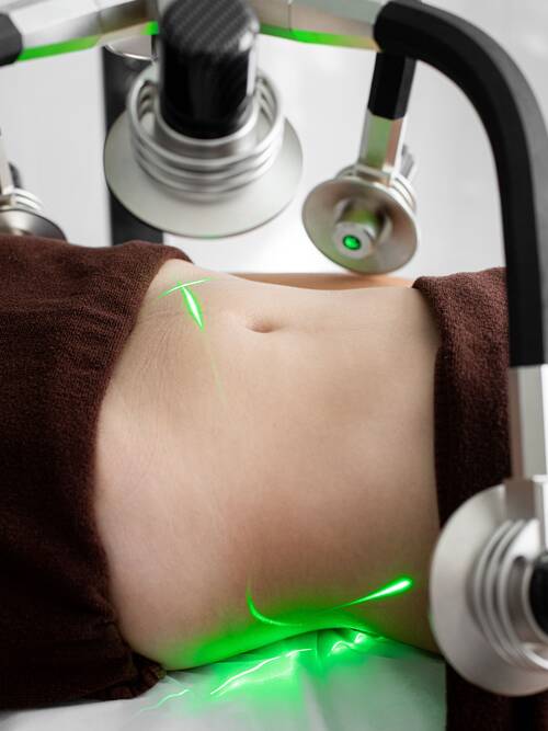 laser-liposuction-singapore-pexels.jpg