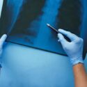 mesothelioma-asbestosis-pexels.jpg