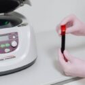 What to Know Before Choosing PRP for Knee Pain