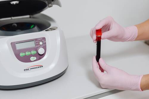 What to Know Before Choosing PRP for Knee Pain