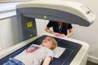 Bone strength could be linked to timing of puberty
