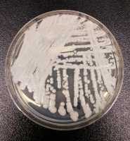 This image depicts a strain of Candida auris cultured in a petri dish at the Centers for Disease Control and Prevention Credit: Shawn Lockhart