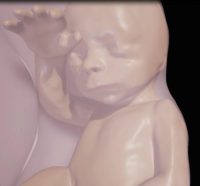 Close-up of fetus at 26 weeks RSNA16