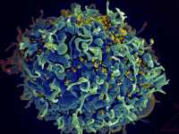 "HIV infecting a human cell" by NIH Image Gallery is licensed under CC BY 2.0