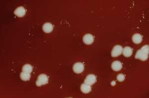 This blood agar plate (BAP) grew colonies of Gram-negative, small rod-shaped and facultatively anaerobic Klebsiella pneumoniae bacteria- CDC image