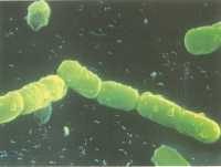 "pseudomonas first bacteria to be patented. professor Chakrabarty" by adrigu is licensed under CC BY 2.0
