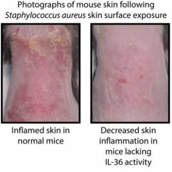 Inflammation on skin of mice. Credit: Lloyd Miller, Johns Hopkins Medicine