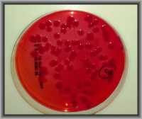 "Escherichia coli" by Iqbal Osman is licensed under CC BY 2.0