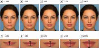 JAMA image doi:10.1001/jamafacial.2016.2049Generating Upper to Lower Lip Ratios Lip ratios are adjusted to keep the most attractive surface area constant. A through D, Images as they appeared to raters in the survey; A and E, 1:2 ratio; B and F, 1:3 ratio; C and G, 1:1 ratio; and D and H, 2:1 ratio.