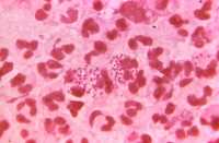 Intracellular Gram-negative, Neisseria gonorrhoeae diplococcal bacteria, - CDC image