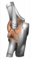 Left Elbow Wikipedia image