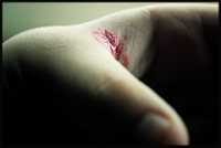 "Left-handed Accident, N\xba 64,738" by minusbaby is licensed under CC BY-NC-SA 2.0 CC BY-NC-SA 2.0