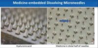microneedles embedded with triamcinolone, a steroid currently used as the first-line treatment of keloids