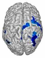 In a study of healthy volunteers, NIH researchers found that taking short breaks, early and often, may help our brains learn new skills. Courtesy of Cohen lab, NIH/NINDS