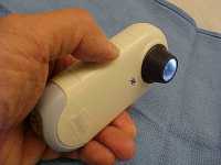 polarized-light-dermatoscope-wikipedia-image