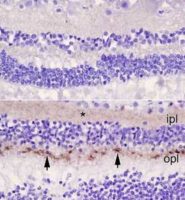 Top, retina of a control patient. Bottom, retina from a patient with CJD. Arrowheads point to abnormal prions in the outer plexiform layer (opl), and the asterisk (*) marks more diffuse prions in the inner plexiform layer (ipl).Orrù et al., mBio