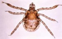 Sheep tick - vector for Coxiella burnetii, the cause of the disease known as Q fever CDC image