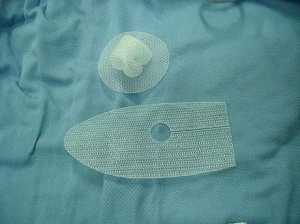 Polypropylene (PP) mesh is currently used in both hernia and pelvic organ prolapses - Wikipedia Image