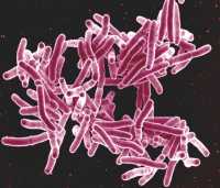 "Mycobacterium tuberculosis Bacteria, the Cause of TB" by NIAID is licensed under CC BY 2.0